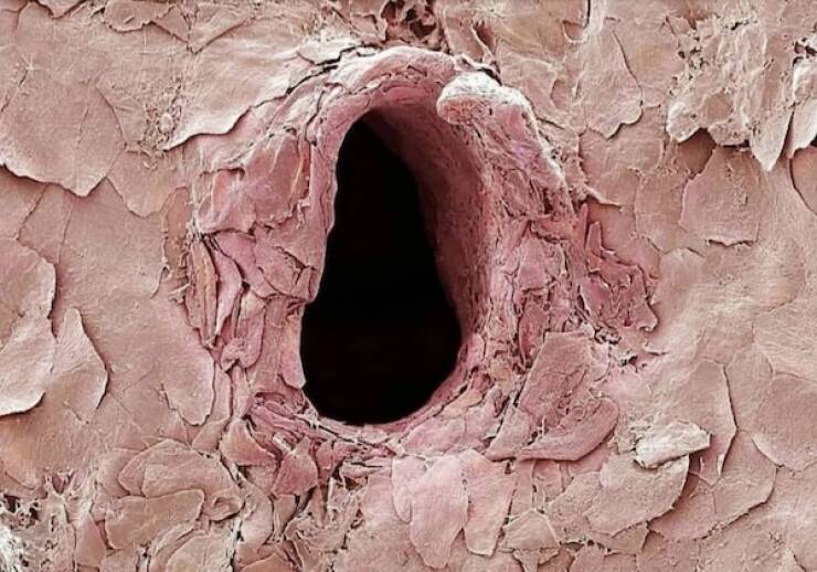 Name:  Human Skin Penetrated by Needle.jpg
Views: 8746
Size:  70.6 KB